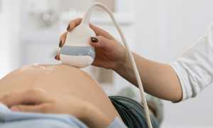 pexels mart production 7089047