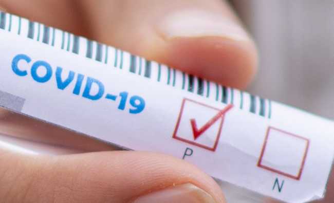 covid positivo test